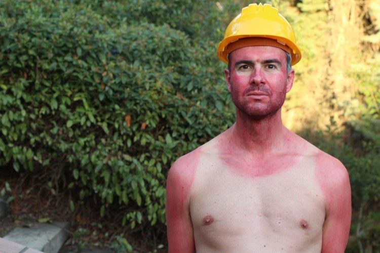 You Need to Protect Your Workers From the Sun - Here's Why